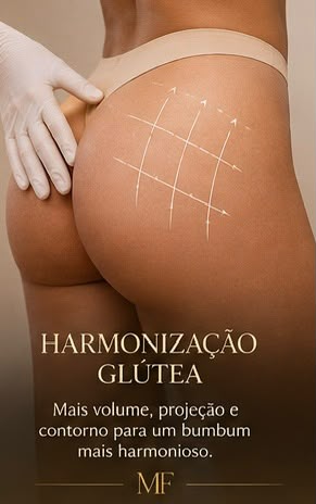 Harmonização glútea com a Dra. Mônica Fernandes